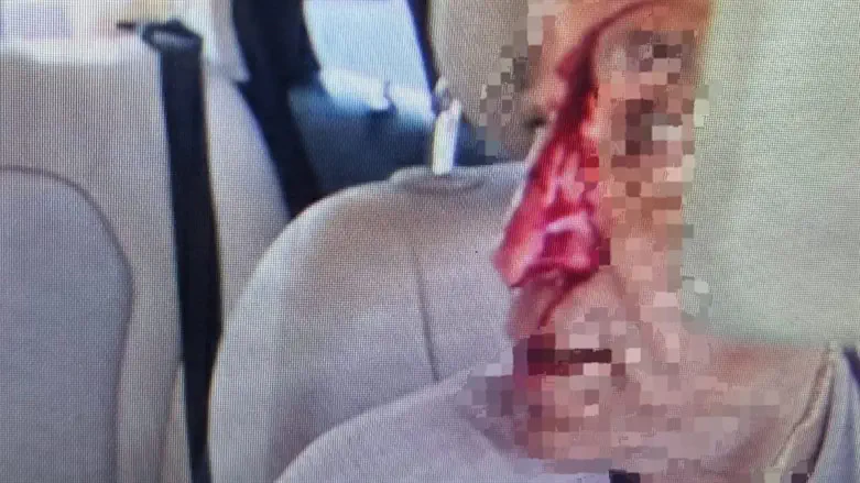 Пострадавший таксист с разбитым носом