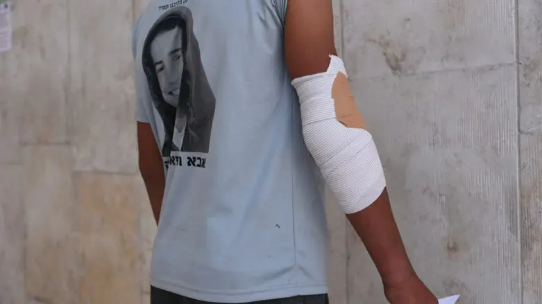 Один из пастухов в больнице