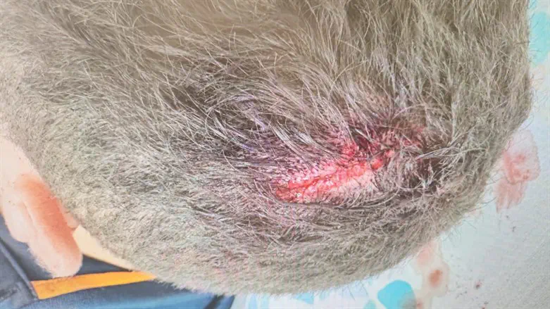 The supervisor's head following the cutting board attack