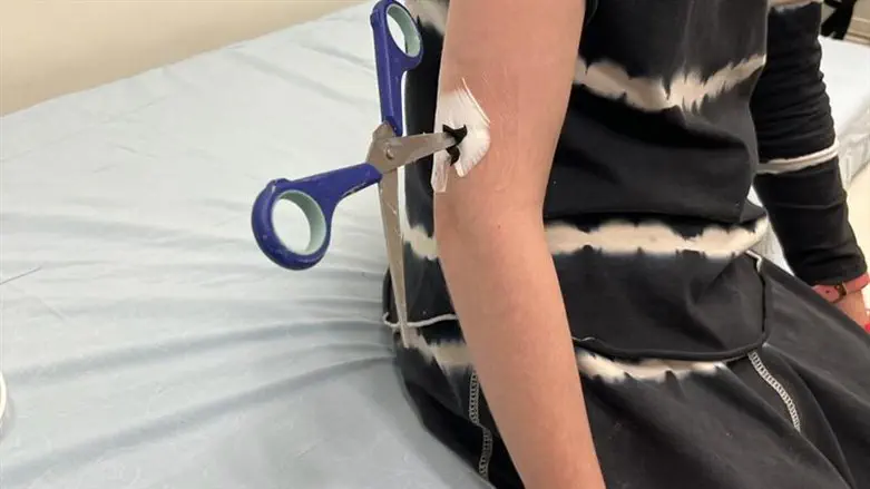 המספריים שננעצו בזרועה של הילדה