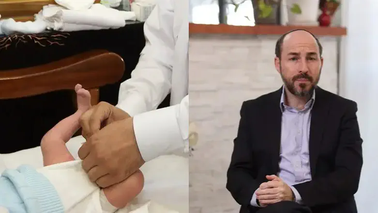 הרב יוני לביא , ברית מילה