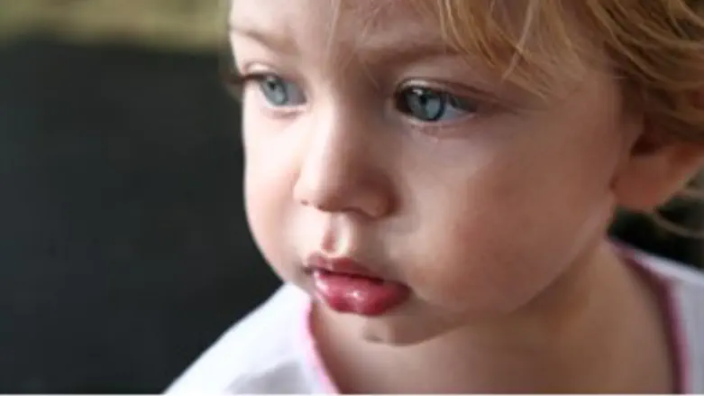 העור - מגן עלינו מינקות