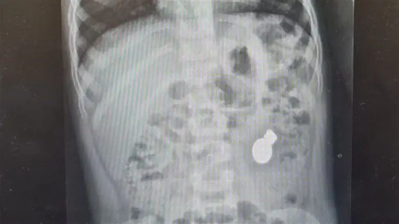 המגנטים והמטבע בצילום רנטגן