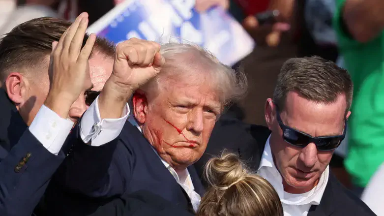 טראמפ לאחר ניסיון ההתנקשות