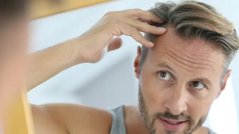 שמפו נגד קשקשים