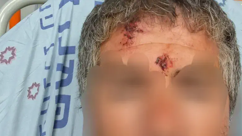 One of the victims