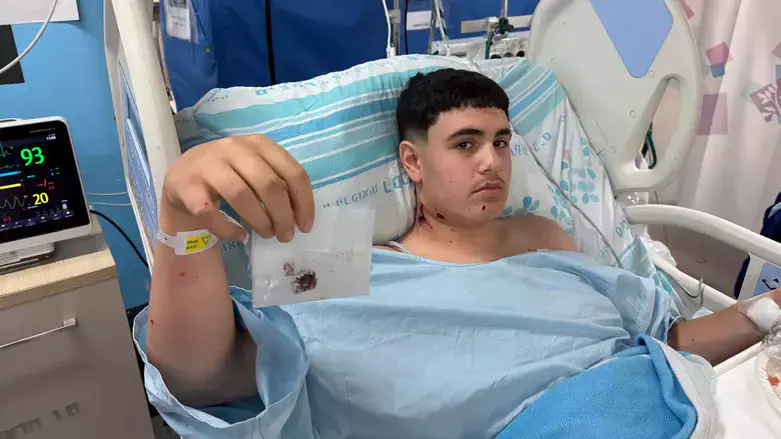Itay with the shrapnel extracted from his body