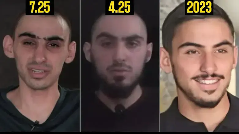 Ром Бреславски: потеря веса в результате голодания