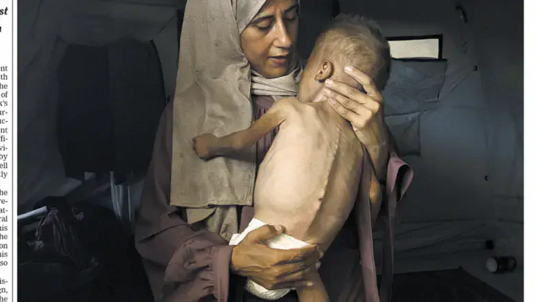 Starvation canard on NYT front page