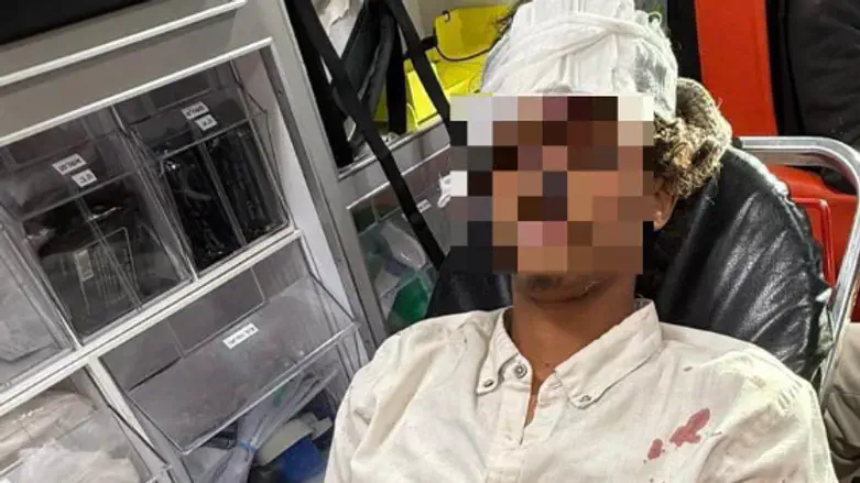 Один из пострадавших