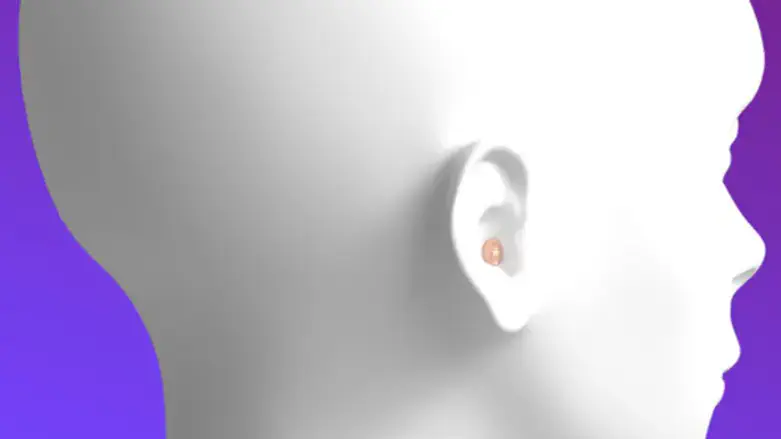 מכשירי שמיעה