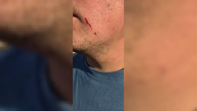 The farm owner who was attacked