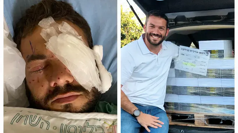 קריגר בפציעה וכעת עם הספר החדש