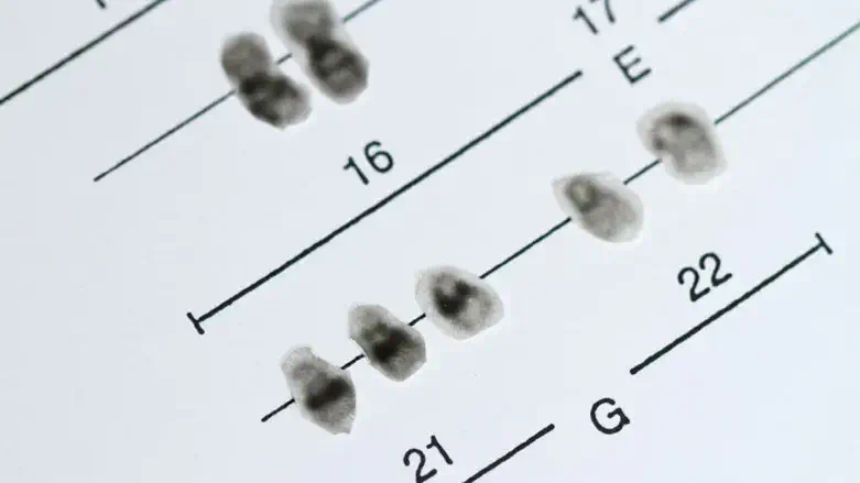 ספינה ביפידה