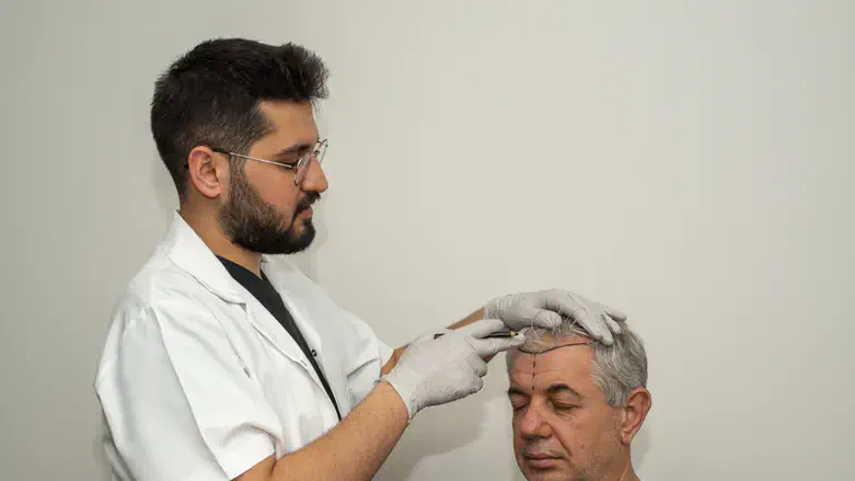 Hair Transplant Clinics in Turkey