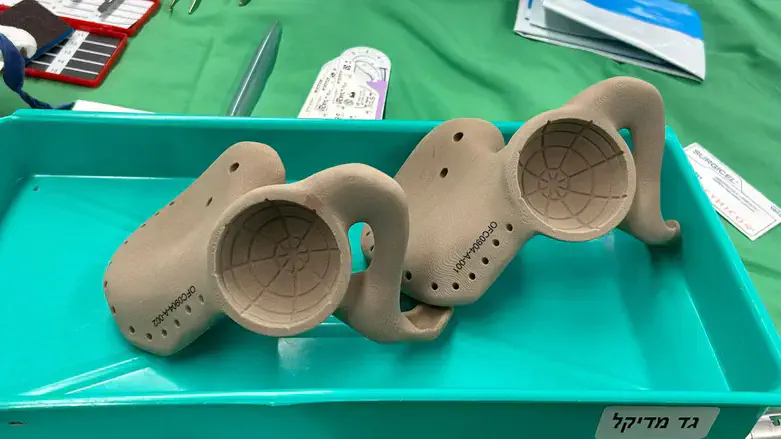 The implants