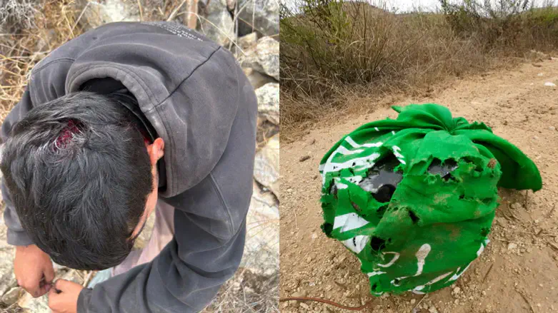 The injured Israeli and dummy explosive