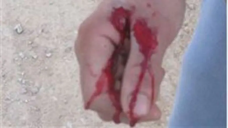 Elyasaf Guri's right hand.