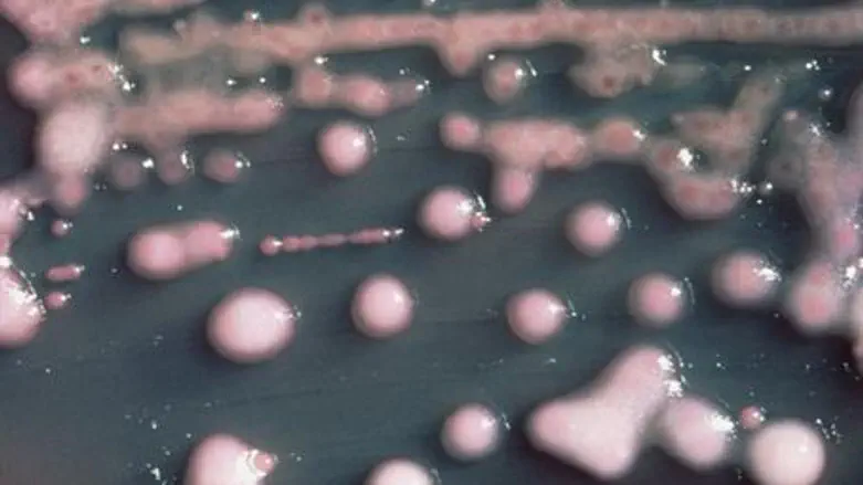 Klebsiella pneumoniae bacteria