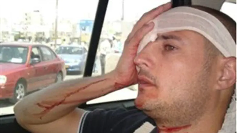 Wounded reporter