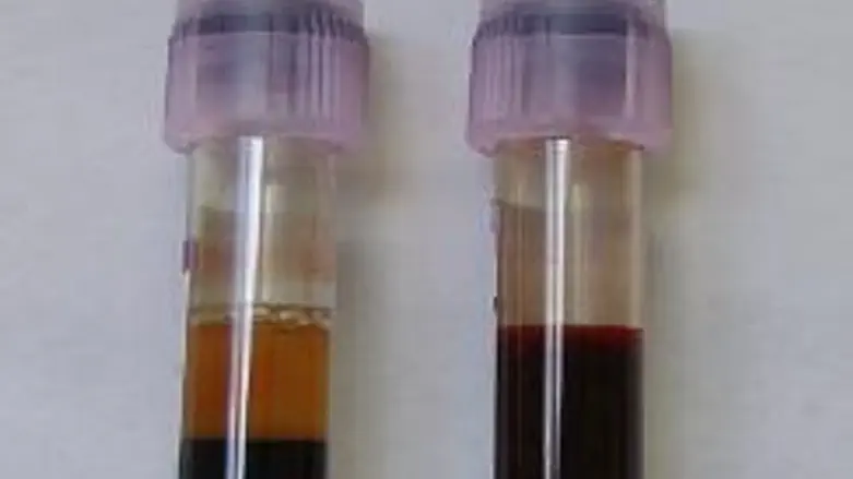 Blood for testing (illustrative)