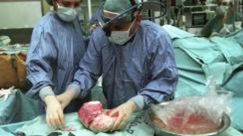 Liver transplant