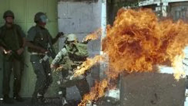 Safe from the knees up: fire bomber