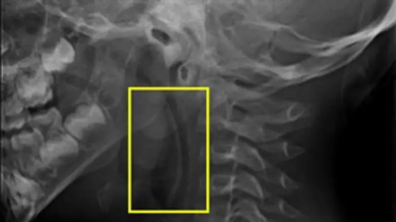 הכפית שנתקעה