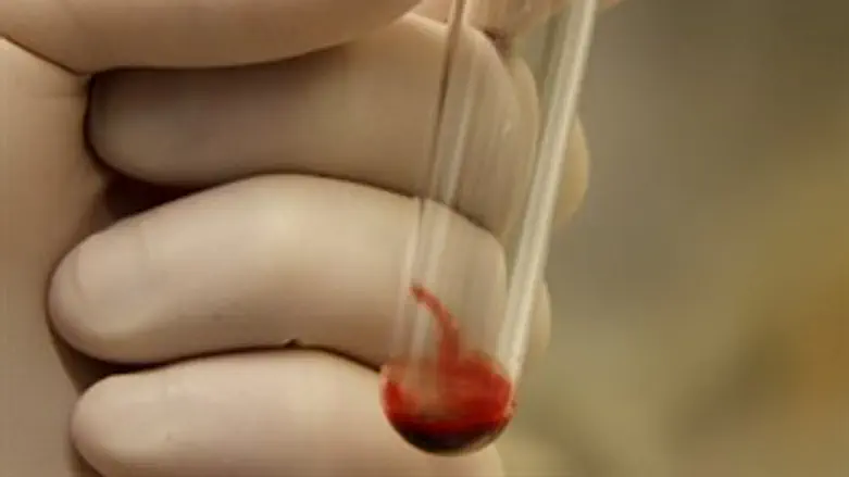 בדיקה מהירה