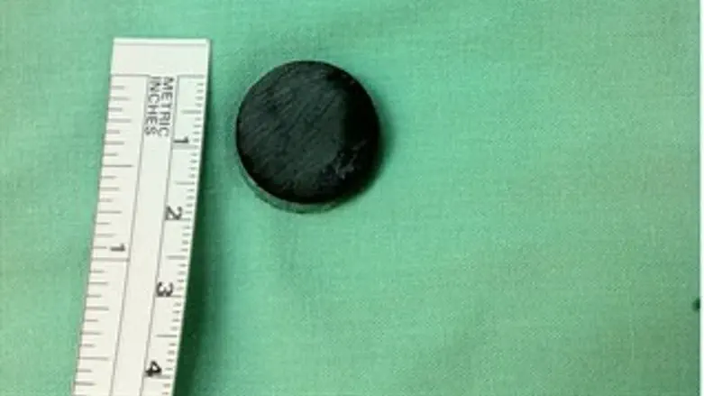 המגנט שהוצא מגופה של הפעוטה