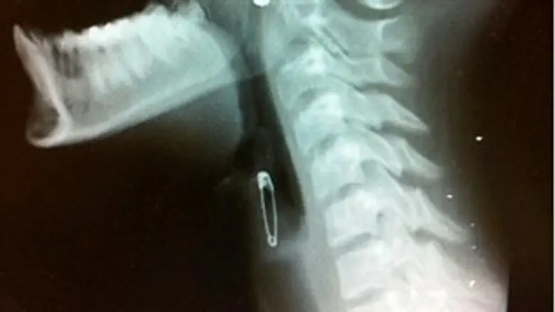 הסיכה האבודה...