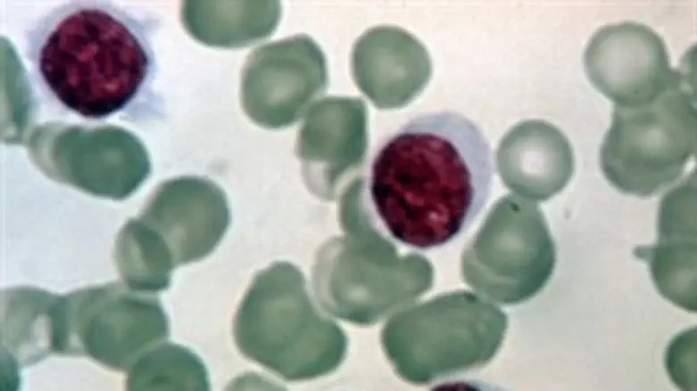 נלחמים בתאים הסרטניים...