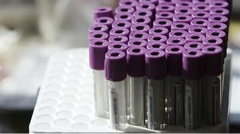 גיבוי כלכלי לאיסוף התרומות