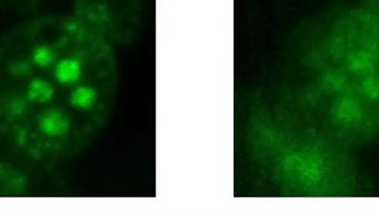 Microscope images of cells (r)with and (l) w