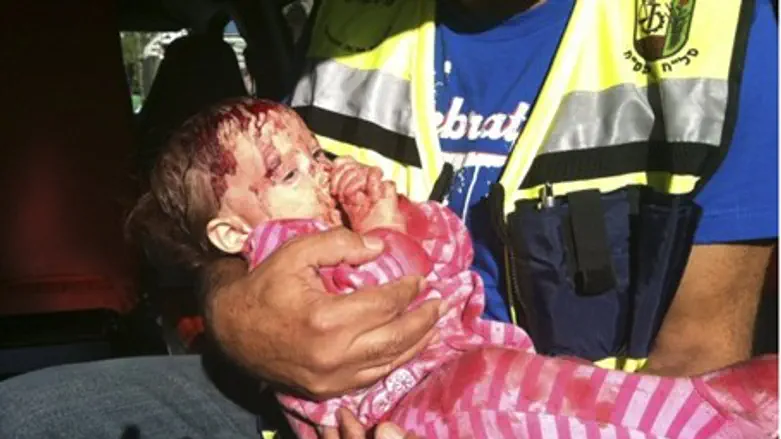 Baby injured in Kiryat Malachi