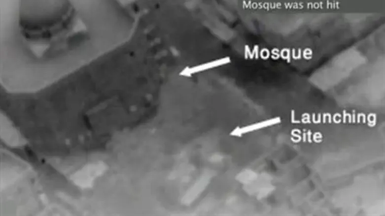 IAF Surgical Targeting