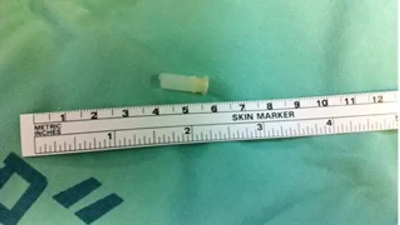 הצפצפה שנבלעה