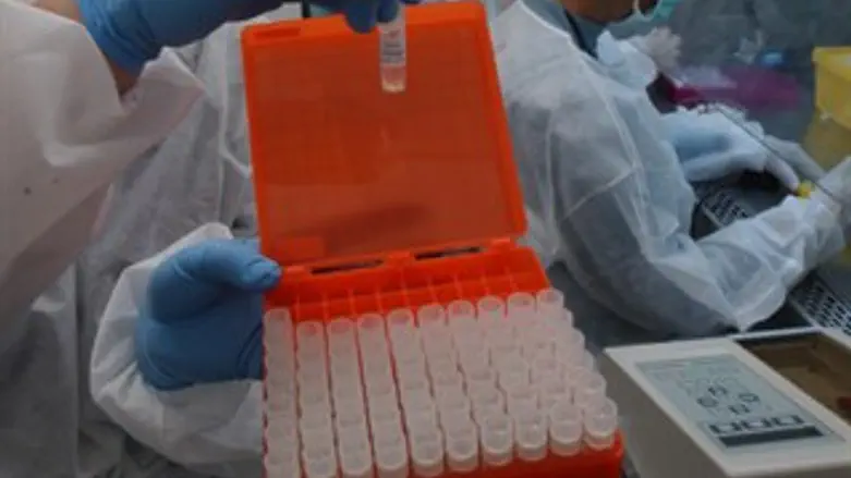 סיבות המוות. משרד הבריאות