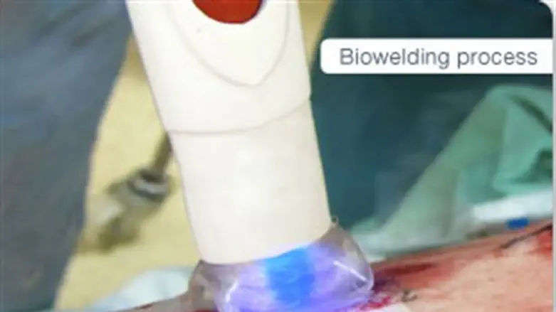 IonMed Biowelding process