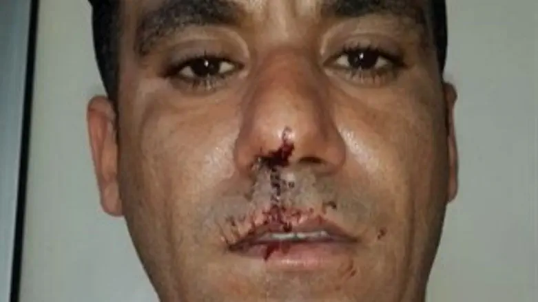 רגע אחרי הלינץ'