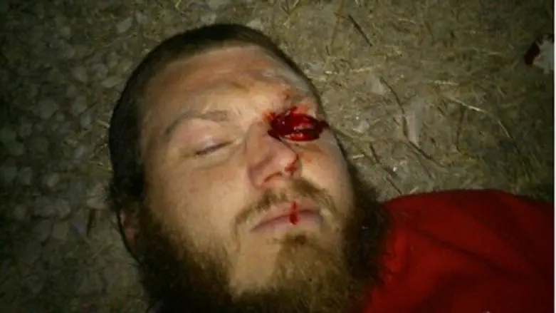 Один из защитников Боаза Альберта от полиции