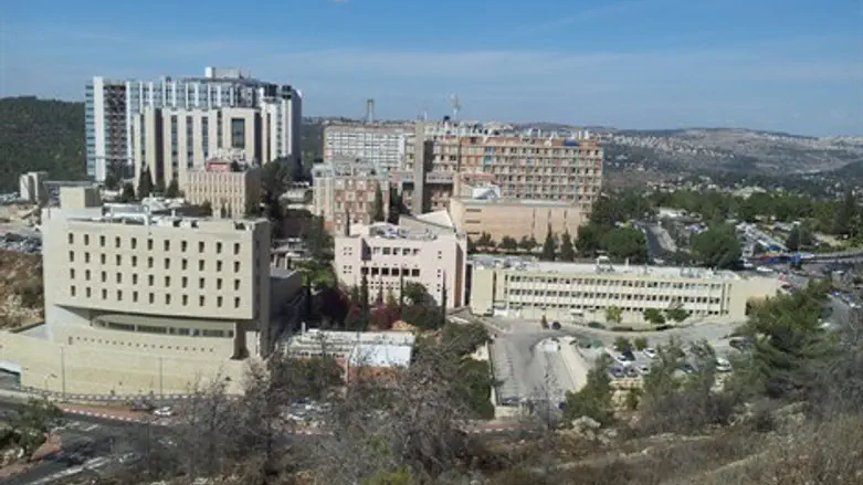 הדסה עין כרם