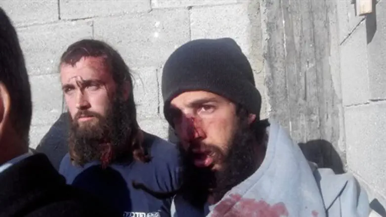 אירועי קוצרא