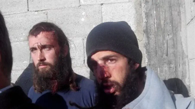 Пострадавшие поселенцы из Эш-Кодеш