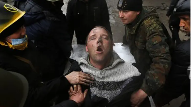 Kiev: wounded protester