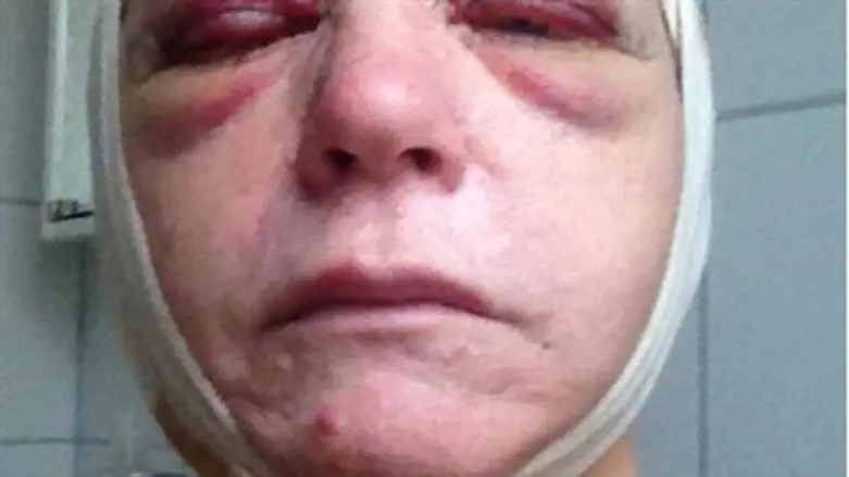 Anna Sjogren following the attack