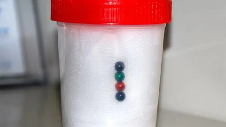 המגנטים שהוצאו מקיבתה של הפעוטה