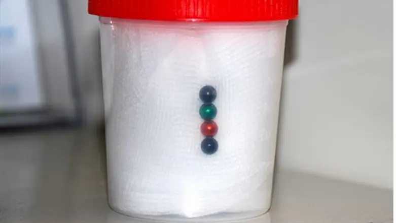 The string of magnets that were swallowed