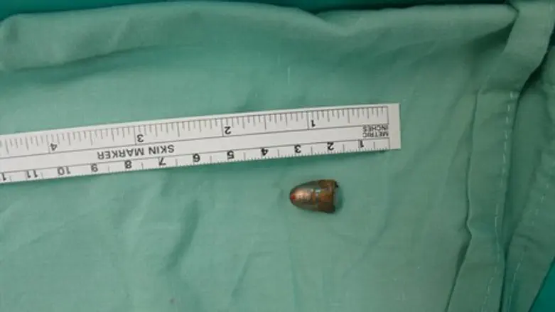 הקליע לאחר הוצאתו.