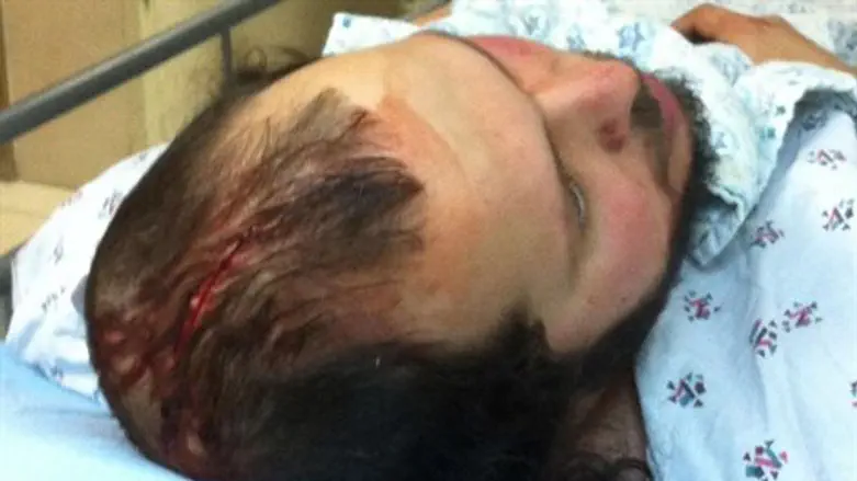 בורשטיין בבית החולים